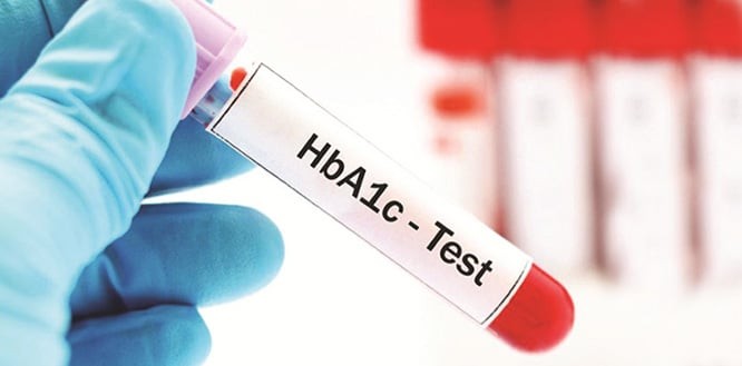 hgb-hemoglobin-testi HGB (Hemoglobin) Nedir? Düşüklüğü, Yüksekliği, Belirtileri ve Tedavisi 