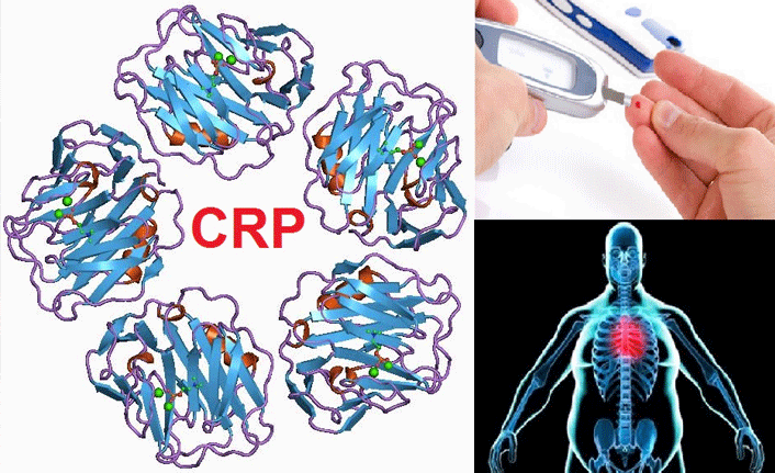 kanda-crp-yukselmesi Kandaki CRP (C-Reaktif Protein) Yüksekliği Nedir? Nasıl Düşürülür? 
